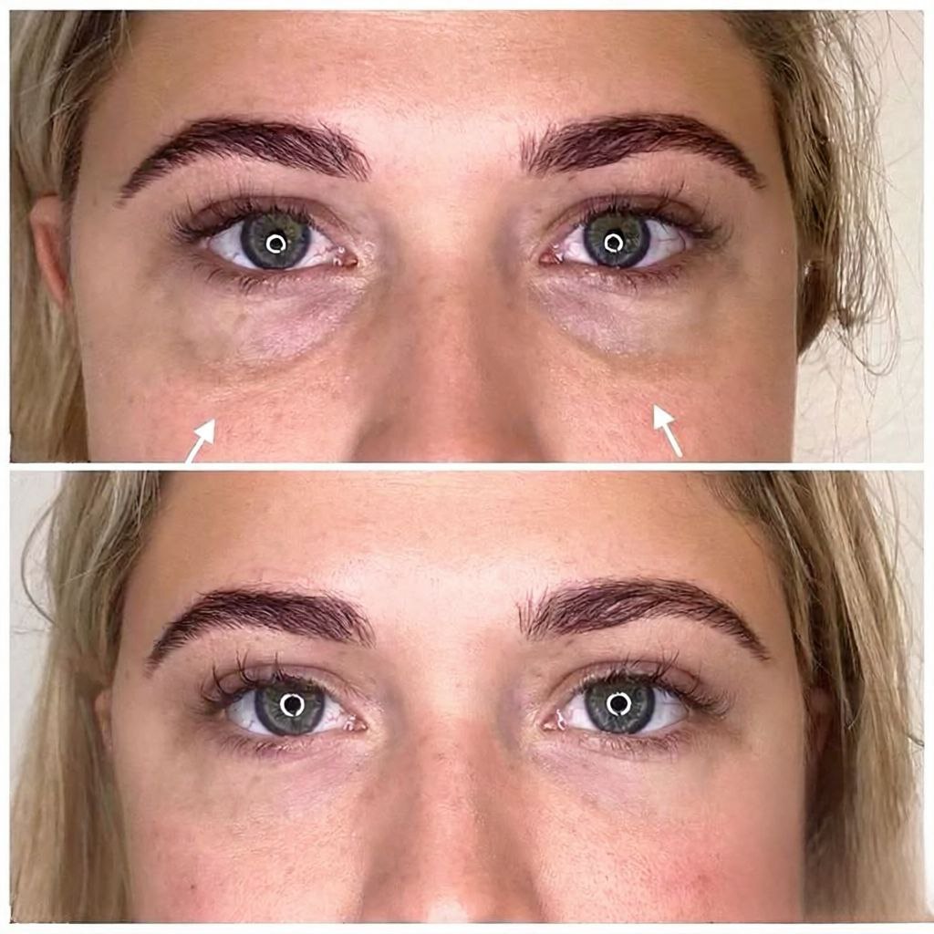 VALIRIANA GLOWCURE UNDER EYE THERAPY - valiriana.com